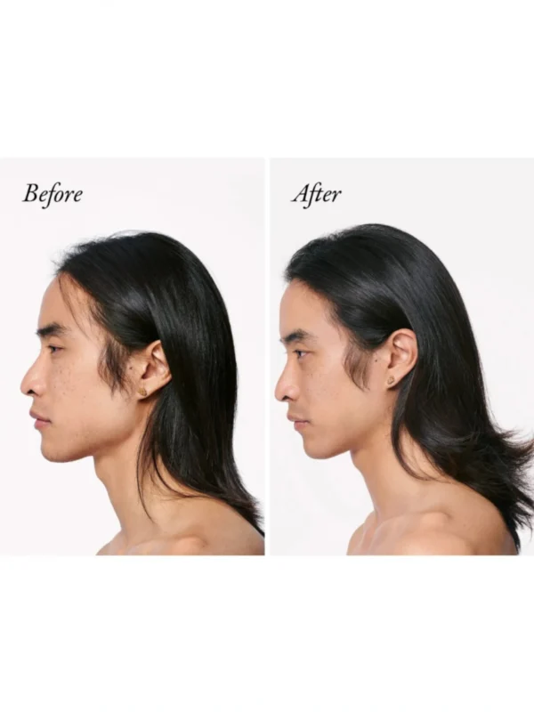 Antes y después del acondicionador Oribe Serene Scalp Densifying Conditioner en cabello masculino con pérdida de densidad