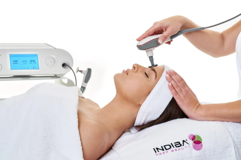 tratamiento indiba facial radiofrecuencia uso estético en clínica